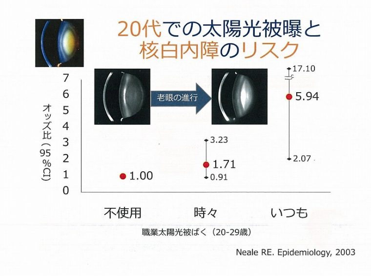 ↑グラフ4：20代での太陽光被曝と核白内障のリスク
