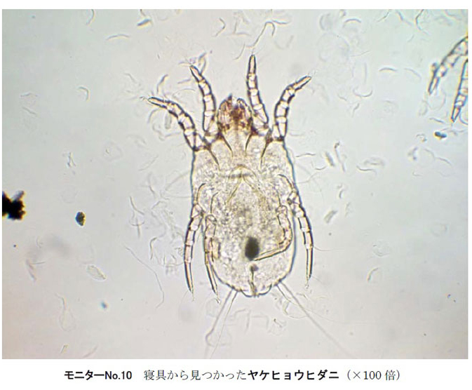 ↑ヤケヒョウダニは一般的なダニで、コナヒョウダニと合わせてイエダニの8割程度を占めているそうです。人間に直接の害は及ぼさないそうですが、死骸やフンがアレルギーを引き起こすそうです