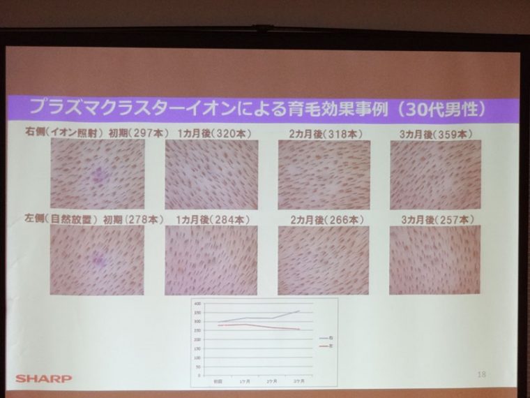 ↑少々わかりにくいが、30代男性の頭皮の写真比較。上列はプラズマクラスターの照射部位