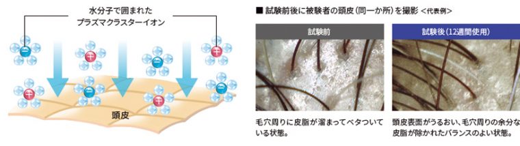 ↑6本機を12週間使用 した際の頭皮。表面 がうるおい、毛穴周 りの余分な皮脂がな くなって健やかに！