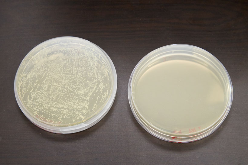↑2枚の布を溶剤に入れて付着しているアクネ菌を溶かし、この溶剤をシャーレに伸ばします。2枚のシャーレを37℃に設定した培養器に2日間保存すると、レイコップを使わなかった培地にはカビのようなアクネ菌が確認できました(写真左)。一方、レイコップを使った培地(写真右)には菌の繁殖が見られません