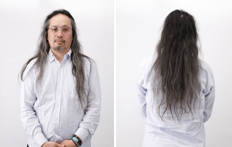↑「スカルプエステ」を使う前の状態。妙なウェーブがかかってますが、クセがついてしまっただけで、パーマをかけているわけではありません。生え際の後退も気になるところ