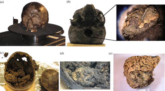 「2600年間も残った脳」の謎を解く鍵がアルツハイマー治療の手がかりにもなるかもしれない