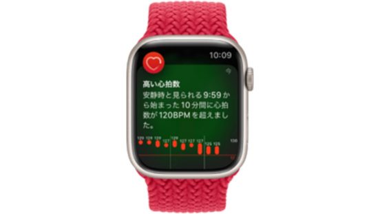 Apple Watch、命に関わる血栓から女性を救う！ 昼寝中に異常な高心拍数を知らせる