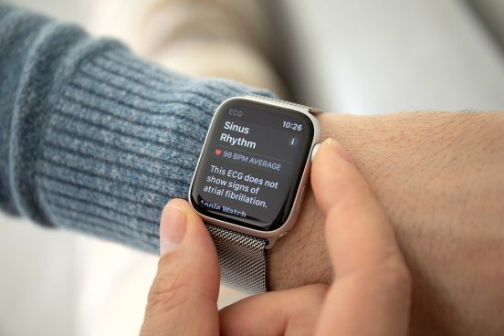 Apple Watchが心房細動を警告！ 妻が自覚症状のない夫を病院に連れて行き健康を取り戻す