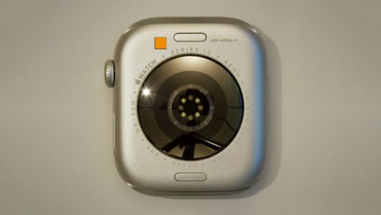 最新Apple Watchに謎の健康センサー？ 試作品が出現
