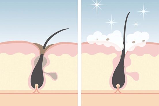 抜け毛・ベタつき・かゆみ……頭髪は悩みの密集地帯!一刻も早く始めるべき毎日のヘアケア方法